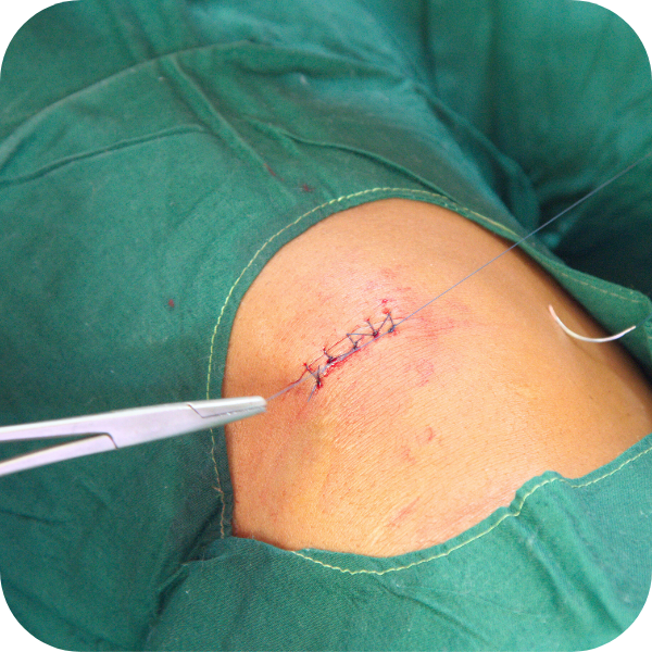 Proceduri și intervenții chirurgicale